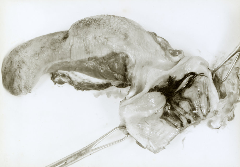 Tongue, larynx and upper trachea of a sheep with spores