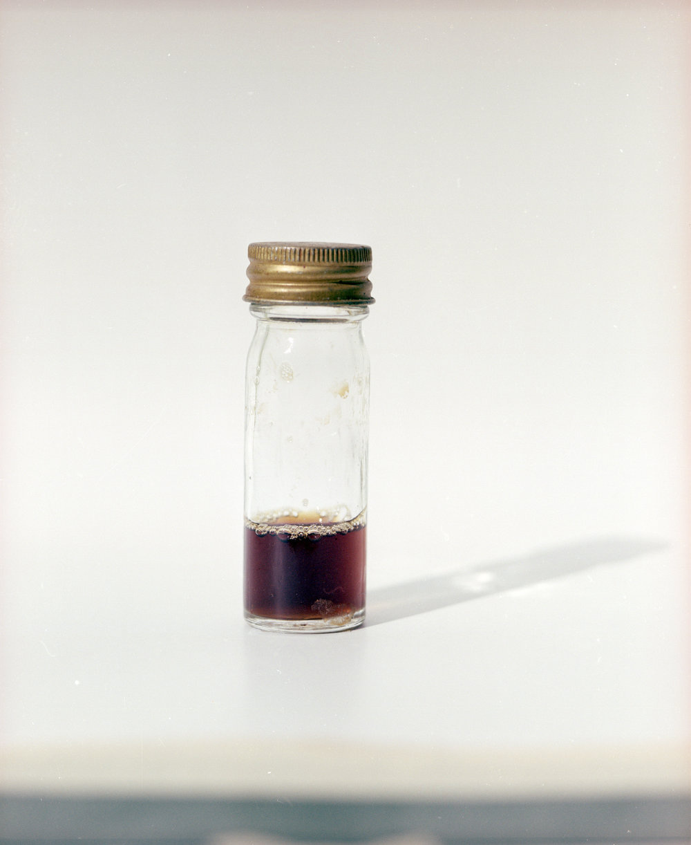Urine sample. 1. Urine that is a dark red/brown