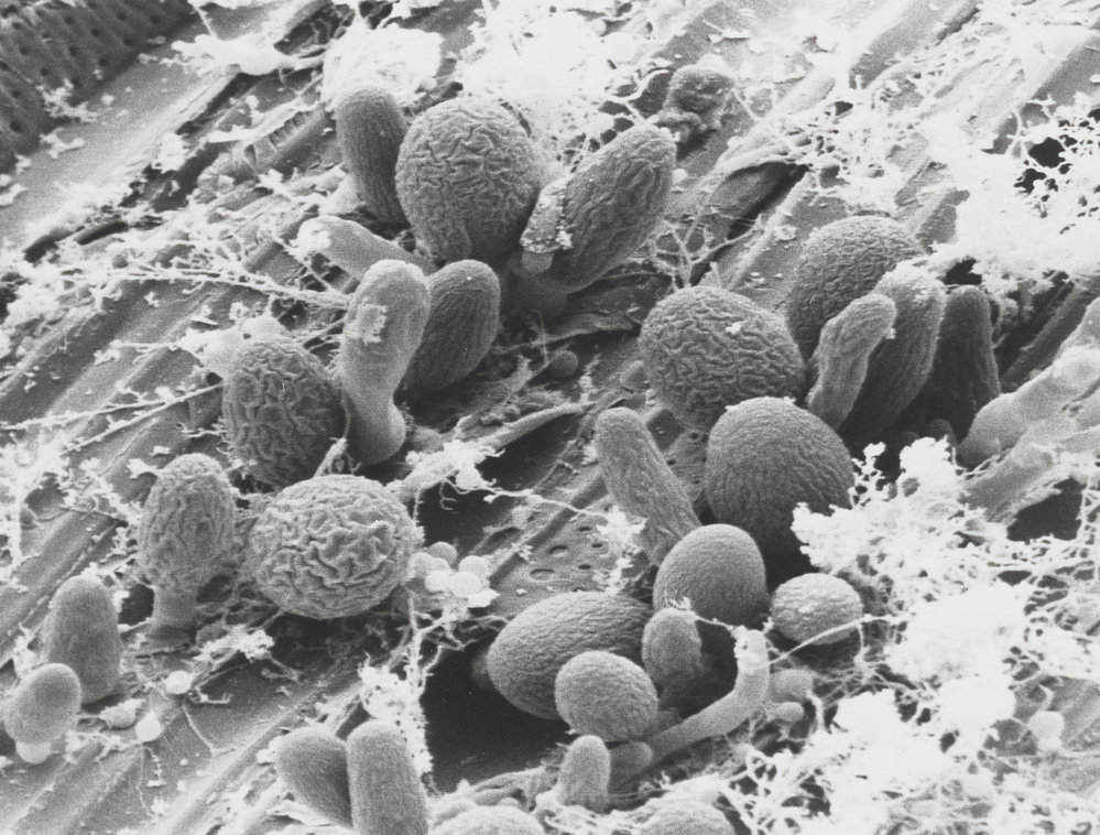 Fungi from sheep's stomach