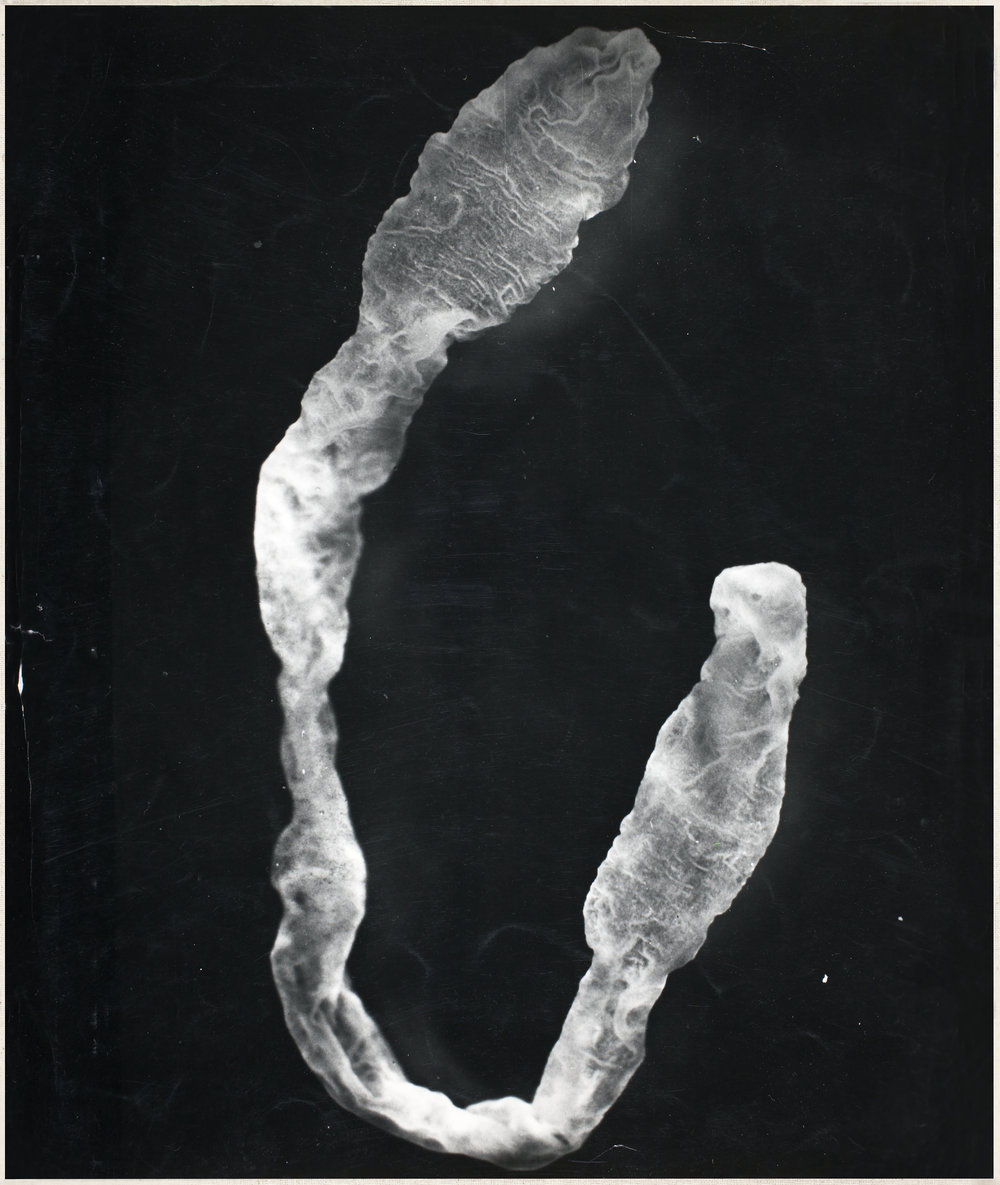 Spirometra tapeworm larva