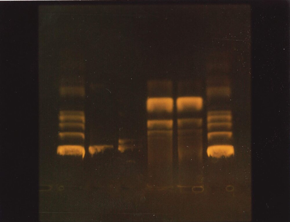 Gel electrophoresis