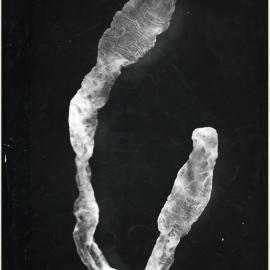 Spirometra tapeworm larva