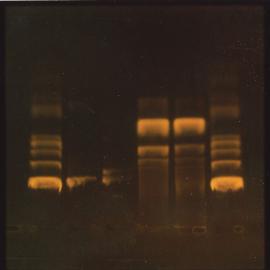 Gel electrophoresis