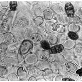 Pithomyces chartarum spore